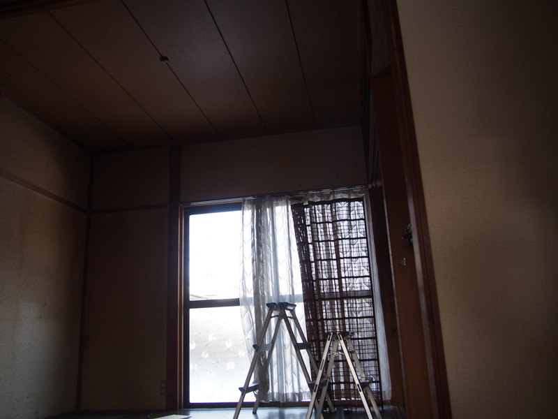 Before③